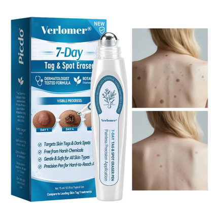 Verlomer® Tag & Spot Eraser Pen
