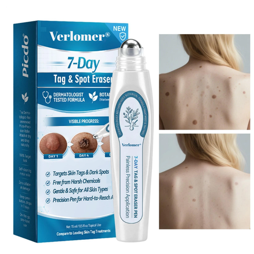 Verlomer® Tag & Spot Eraser Pen